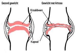 gebit